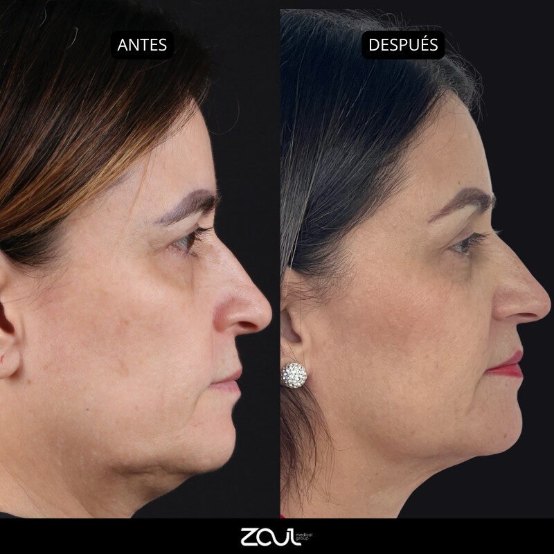 RETRACTION - Dra Carolina Hoyos